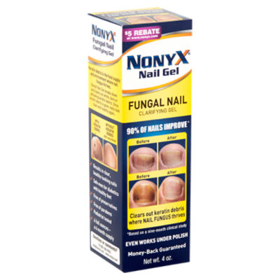 Nonyx Fungal Clarifying Nail Gel, 4 oz